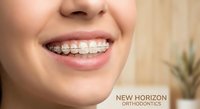 Young woman with metal braces smiling showing orthodontic treatment for teeth straightening and dental care in modern clinic setting.