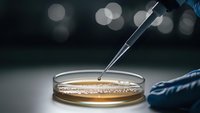 Laboratory scientist using precision pipette to extract sample from petri dish in sterile research environment for medical testing and analysis.