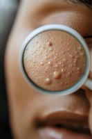 Close-up magnified view of facial skin texture showing pores, blemishes and natural skin surface through round magnifying glass against Asian woman's face.