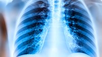 Chest x-ray scan showing human ribcage and spine in bright blue color on black background, medical diagnostic radiography examination of thoracic skeleton structure.