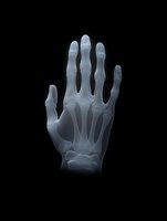 X-ray of human hand showing skeletal structure, bones, and joints isolated on black background. Medical imaging for healthcare, radiology, anatomy education, and diagnostic purposes.