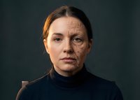 Middle-aged Caucasian woman with half face showing aging wrinkles and spots, skincare concept for anti-aging treatments and dermatology research.
