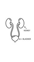 Medical diagram showing human urinary system anatomy with kidneys, ureters and bladder labeled on white background for educational healthcare materials.