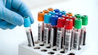 Medical laboratory technician in blue gloves handling blood sample test tubes with colorful caps for diagnostic analysis and healthcare testing.