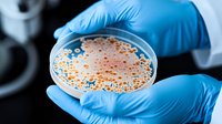 Scientist in blue gloves holding petri dish with orange bacterial culture growing in laboratory environment, close-up view showing detailed colony formation.