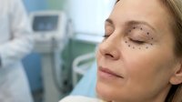 Middle-aged Caucasian woman with surgical markings around eyes preparing for cosmetic eyelid surgery in modern medical clinic setting.