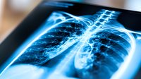 Chest x-ray scan showing detailed skeletal structure and ribcage in glowing blue tones against dark background, medical diagnostic radiography examination view.
