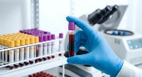 Medical laboratory technician in blue gloves holding blood sample test tube for analysis with microscope and test tubes in clinical research facility.