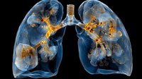 Translucent blue human lungs with glowing orange inflammation areas showing disease progression, medical visualization on black background for healthcare education.