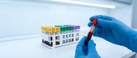 Medical laboratory technician in blue gloves holding blood sample vial with test tubes rack in sterile clinical environment for diagnostic analysis.