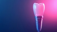 Dental implant with crown on gradient neon background showing modern dentistry technology and oral healthcare advancement in contemporary medicine.