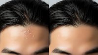Before and after skincare treatment showing oily to smooth forehead transformation for beauty and cosmetic advertising campaigns.