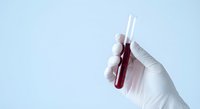 Medical professional in white gloves holding blood sample test tube for laboratory analysis and diagnostic testing in healthcare setting.
