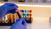Laboratory technician in blue gloves holding test tube with blood sample for medical analysis and diagnostic testing in clinical research facility.