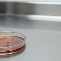 Petri dish with bacterial culture colonies on orange agar medium in sterile laboratory environment for microbiology research and medical testing.