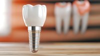 Dental implant with crown on wooden surface against blurred teeth background, modern dentistry and oral healthcare concept for medical design.