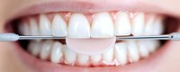 Close up of healthy white teeth with dental floss between them showing proper oral hygiene technique and preventive dental care routine.