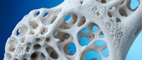Close-up view of porous bone structure showing osteoporosis effects with detailed trabecular architecture against blue medical background.
