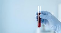 Medical professional in blue latex gloves holding test tube with blood sample for laboratory analysis and diagnostic testing in clinical setting.