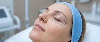 Woman with marked facial lines for cosmetic surgery consultation lying on medical table in clinic preparing for aesthetic procedure.