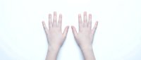 Two open human hands with palms down on white background, fingers spread, clean minimalist composition for healthcare or beauty concepts.